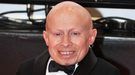 Verne Troyer, Mini Yo en 'Austin Powers', hospitalizado tras sufrir un ataque