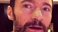 Hugh Jackman vuelve a recibir tratamiento por su cáncer de piel