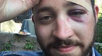 Un hombre es atacado en Nueva York por su parecido con Shia LaBeouf