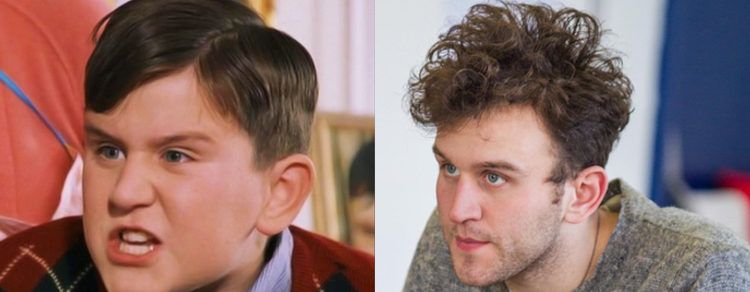 Harry Melling antés y después