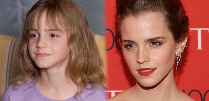 Antes y después de Emma Watson