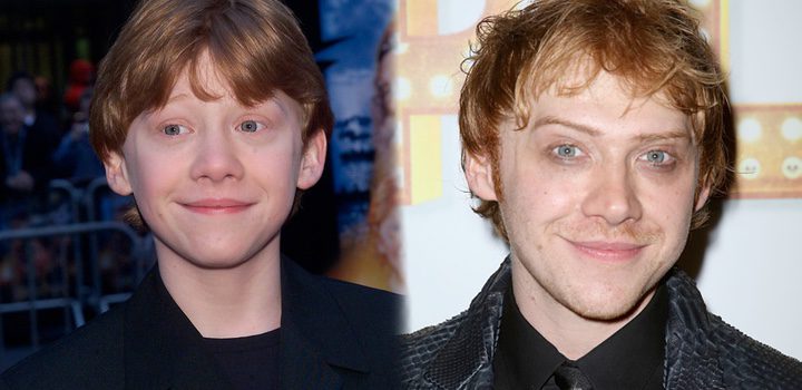 Antes y después de Rupert Grint