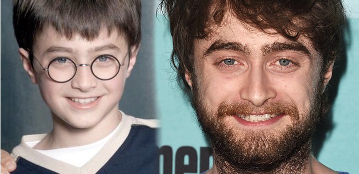 Antes y después de Daniel Radcliffe