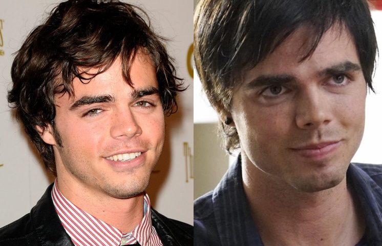 Reid Ewing antes y después de la cirugía plástica