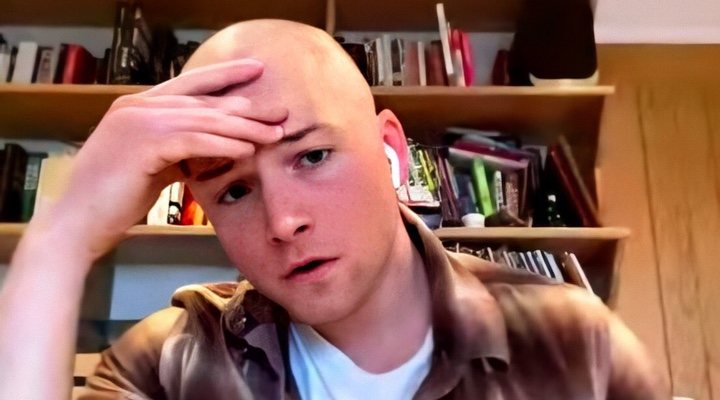  Taron Egerton rapado al cero