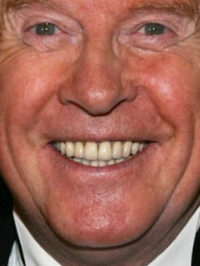  Michael Crawford