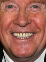 Michael Crawford