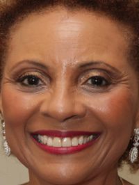  Leslie Uggams