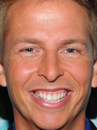  Jack McBrayer