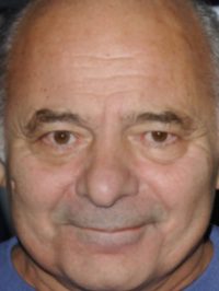  Burt Young