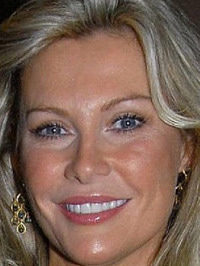  Alison Doody