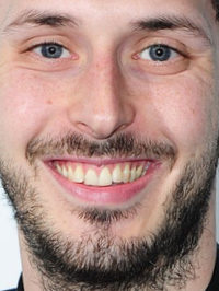  Blake Harrison