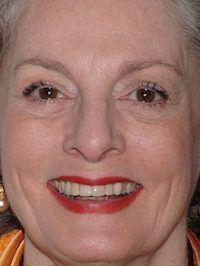  Dana Ivey